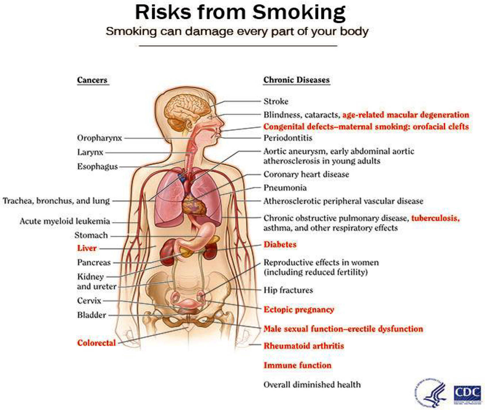 You and Your Health: Smoking